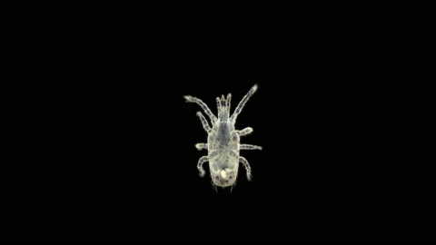 Predatory mite (acari) order Mesostigmata under a microscope Stock Footage 154855197