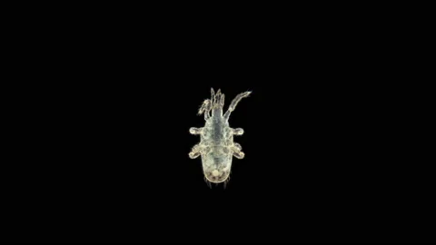 Predatory mite (acari) order Mesostigmata under a microscope Stock Footage 154885158
