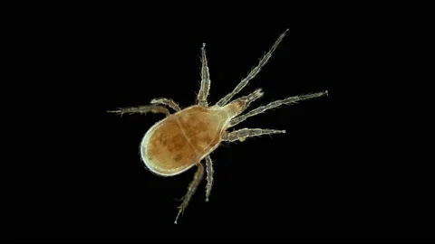 Predatory mite (acari) under a microscope, Parasitidae family Stock Footage 155435442