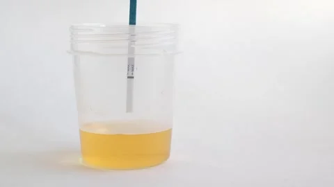 Pregnancy test in action. Two lines mean pregnant. Close up. Stock Footage 269142206