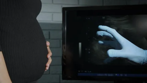 Pregnant refuse from help. Stock Footage 259205089