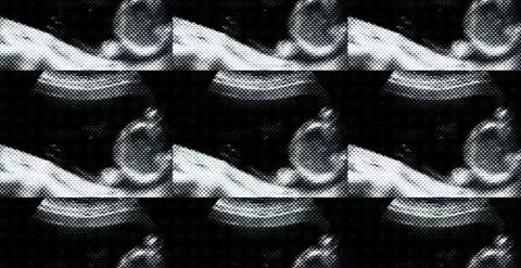 Prenatal diagnostic echography displaying first trimester fetal development.. Stock Footage 320387894