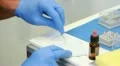 Preparation acrylic material for a dental imprint HD Footage