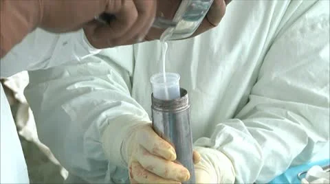 Preparation of bone cement for arthroplasty 2 Stock-Footage 10579654