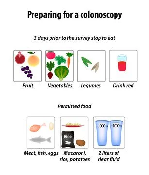 Preparing for a colonoscopy. Diet for Colonoscopy. Vector illustration on Stock Illustration