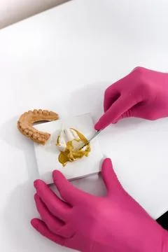 Preparing a dental impression from mixed material for future prosthetic or or Stock Photos