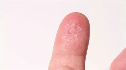 Preparing Finger for Blood Glucose Test 01 bleeding Video stock 10744844