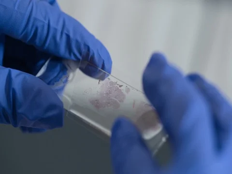 Preparing the laboratory sample on glass Vídeo Stock 75764839