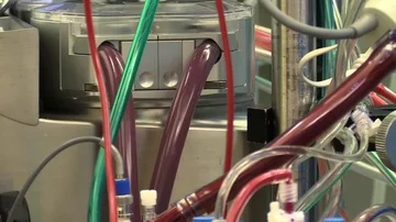 Preparing the patient in the operation block Stock Footage 85897500