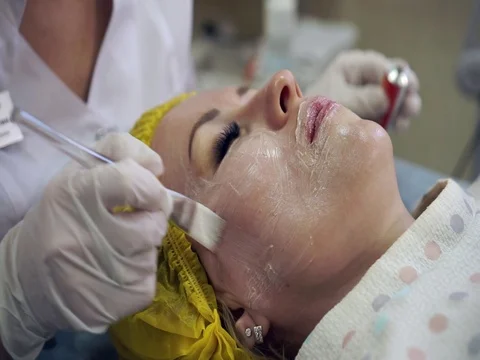 Preparing for the process of biorevitalization. Application of cream for Video stock 77630312