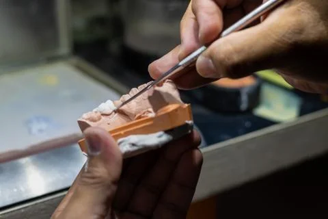 Preparing the prosthetic tooth for being cooked in the oven Stock Photos