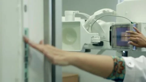 Preparing Roentgen for procedures and X-ray images Video stock 168569348