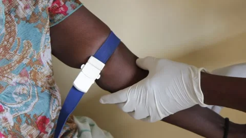 Preparing a vein before drawing blood Stock Footage 147496443