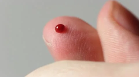Press out a blood drop Video stock 12357092