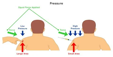 Pressure Infographic Diagram example touching shoulder by finger and injection Stock-Illustration