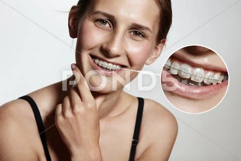 Prety girl is smiling with braces and lens showing them bigger Stock Photos