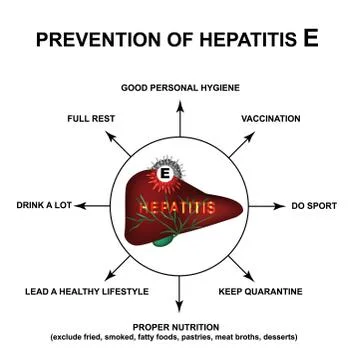 Prevention of Hepatitis E. World Hepatitis Day. Infographics. Vector Stock Illustration