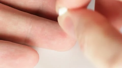 Prick finger Stock Footage 12357097