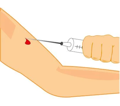 Prick in hand Stock Illustration