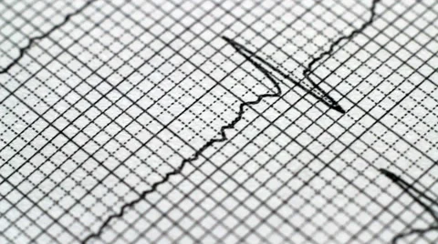 Printing an ECG in paper Stock-Footage 36475931