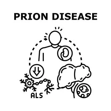 Prion disease affecting human brain and nervous system Stock Illustration
