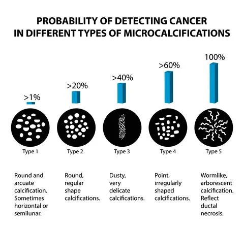 The probability of detecting breast cancer with different types of Illustrazione stock