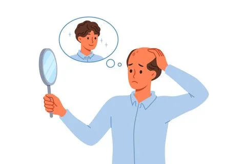 Problem of baldness in man looking in mirror and remembering presence of 库存插图