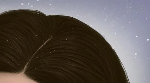 The problem dandruff of scalp. Dandruff is a skin condition that mainly affec Stock Illustration