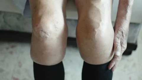Problem of heavy pain and chronic rheumatism of knees joints, ill pensioner Stock Footage 223348800