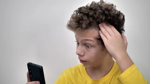 Problematic skin of a young man with curly hair. Pimples on the forehead. The Stock Footage 243210969