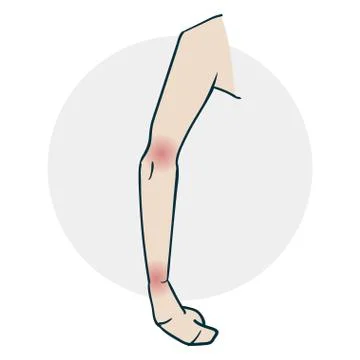 Problems with the limb joints Stock Illustration