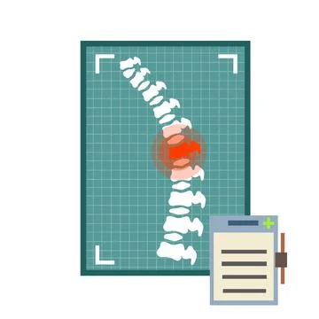 Problems with spine. Posture issues isolated on white Stock Illustration