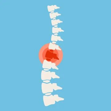 Problems with spine. Posture issues. Sick red place. Crack in White bone Stock Illustration