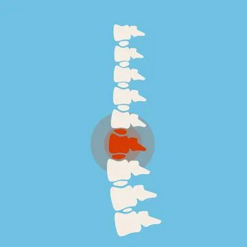 Problems with spine. Posture issues. Sick red place. Crack in White bone. Stock Illustration