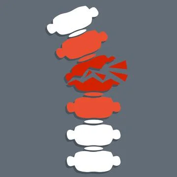 Problems with spine. Posture issues. Sick red place. Crack in White bone Stock Illustration