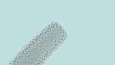 Proboscis of the worm Nemertea Prostoma sp. under a microscope from the Stock Footage 158872686