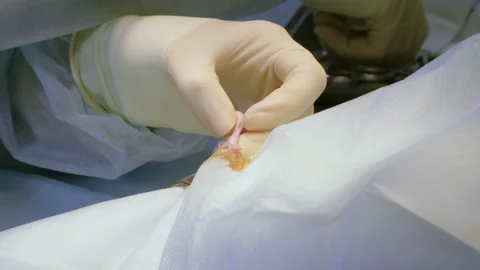 The procedure of castration. Veterinary surgeon operating a cat in a clinic. 4K Vidéo 94440053