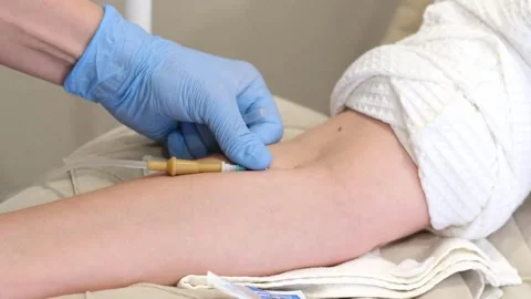 The procedure of drip administration of cosmetics, demonstrating the use of vita 動画素材 314910661