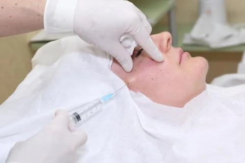 Procedure of face lifting surgery. Stock Photos