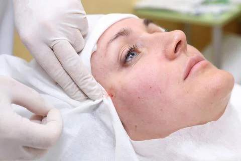 Procedure of face lifting surgery. Foto stock
