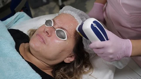 The procedure of laser correction of the face in a cosmetic clinic. Stock Footage 125798538