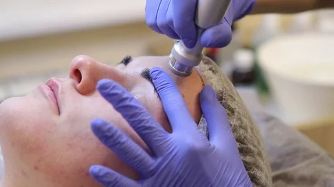 Procedure of Microdermabrasion. Stock Footage 88078271