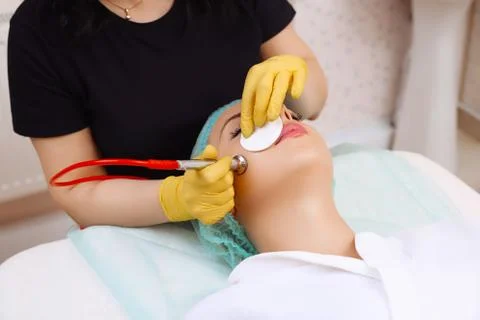 Procedure of Microdermabrasion. Stock Photos