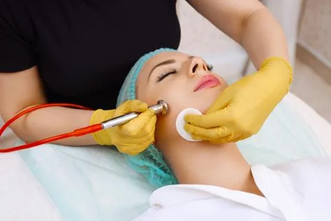 Procedure of Microdermabrasion. Stock Photos