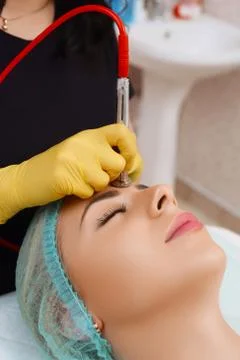 Procedure of Microdermabrasion. Stock Photos