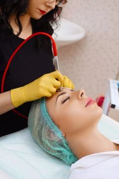 Procedure of Microdermabrasion. Stock Photos