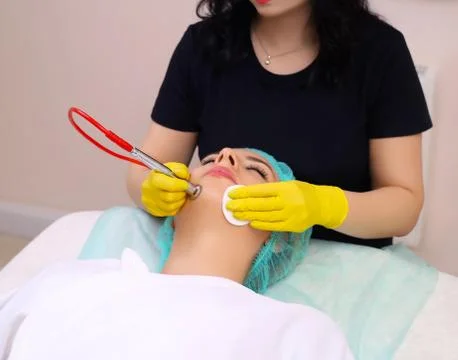 Procedure of Microdermabrasion. Stock Photos