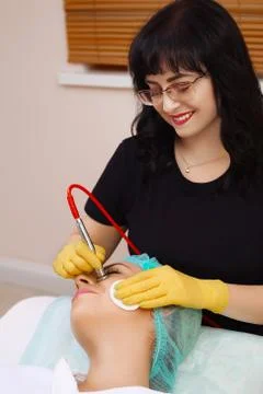 Procedure of Microdermabrasion. Stock Photos
