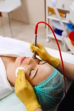 Procedure of Microdermabrasion. Stock Photos