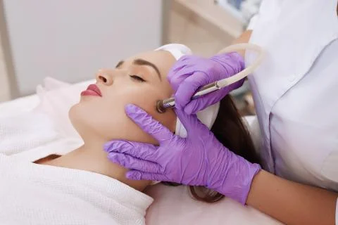 Procedure of Microdermabrasion. Stock Photos